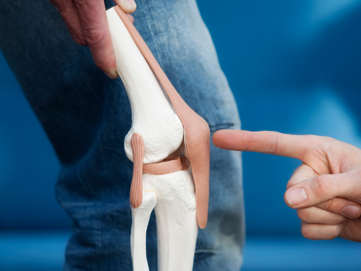 Artrose knie Focuskliniek Orthopedie