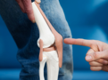 Mogelijkheden voor een artrotische knie